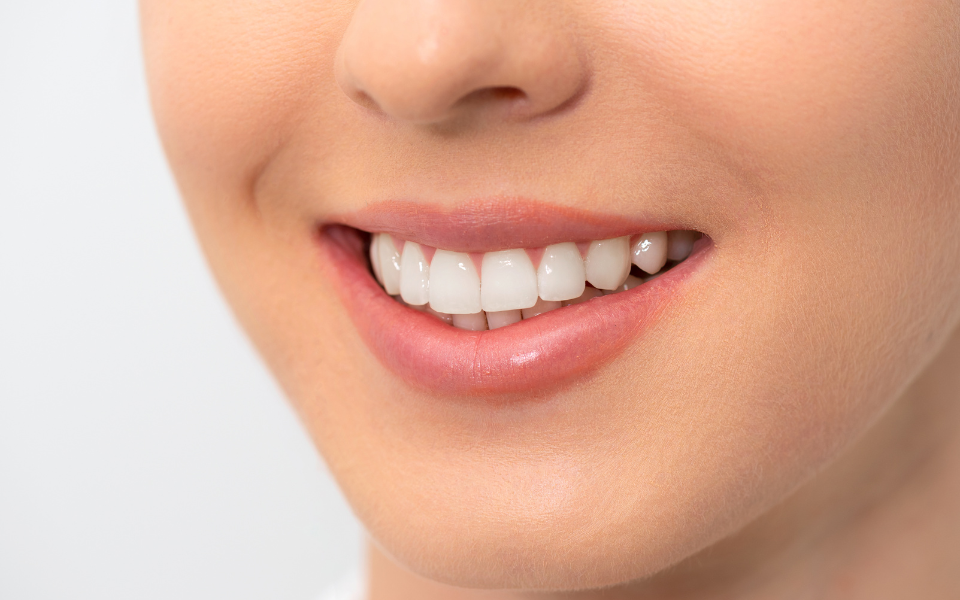 3 Mitos sobre clareamento dental que você precisa deixar de lado