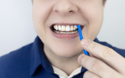 Escovas interdentais podem substituir o Fio Dental?